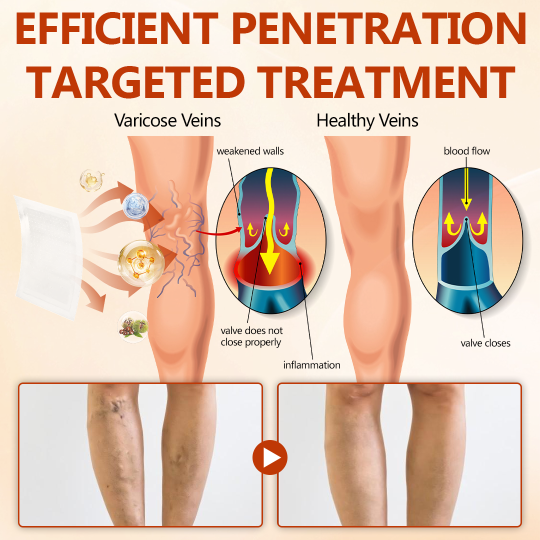 🔥 LIMITED SPECIAL OFFER🔥Acezozla® VeinRepair Microneedle Patch Roll (Advanced Microneedle Vein Repair Patch for Bulging Veins, Swelling, Heavy Legs & Daily Leg Discomfort)