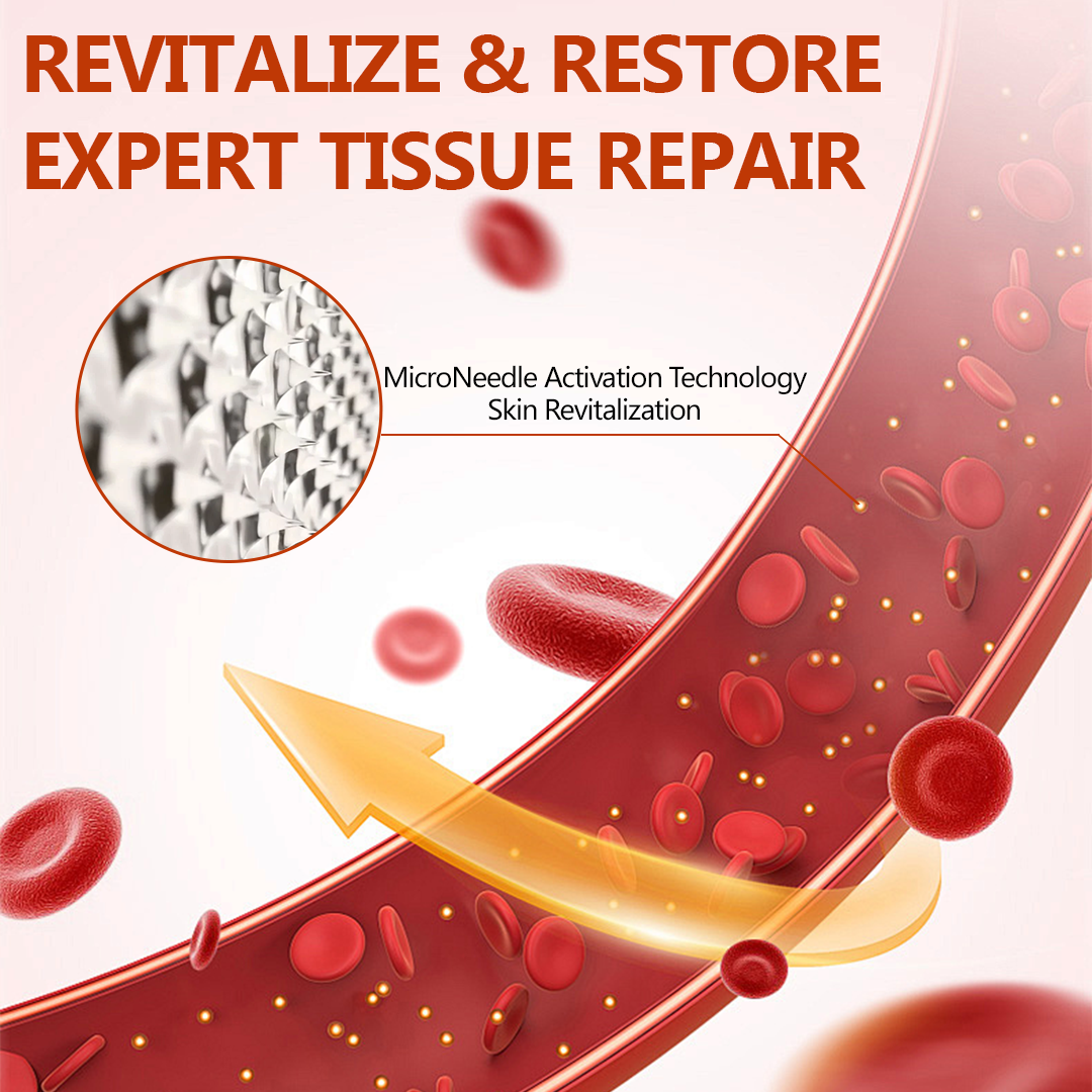 🔥 LIMITED SPECIAL OFFER🔥Acezozla® VeinRepair Microneedle Patch Roll (Advanced Microneedle Vein Repair Patch for Bulging Veins, Swelling, Heavy Legs & Daily Leg Discomfort)