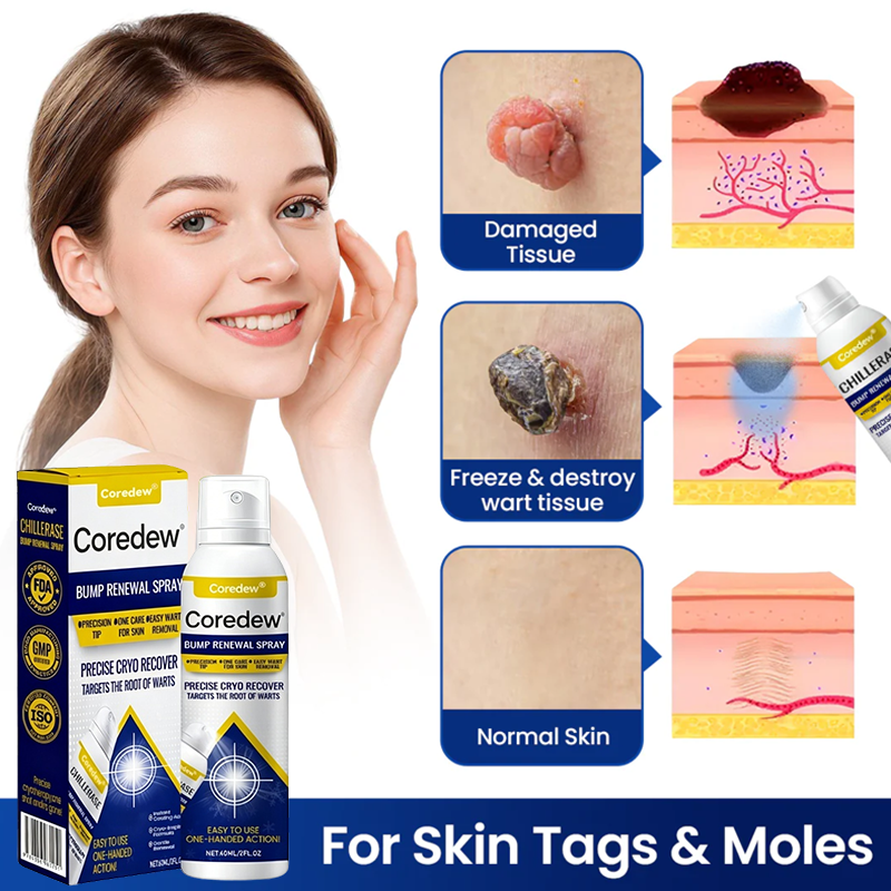 Coredew® ChillErase Bump Renewal Spray
